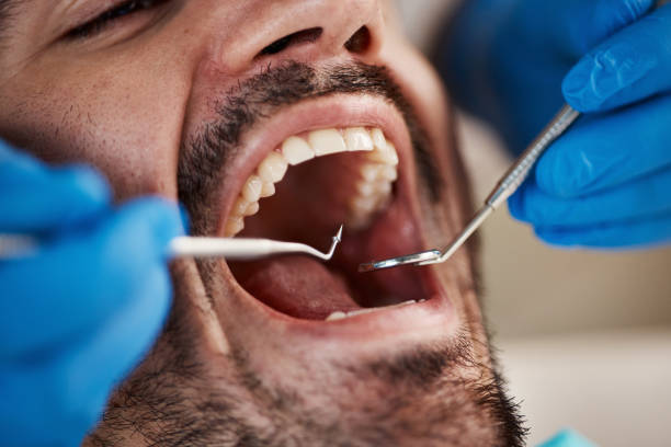 Best Emergency Broken Tooth Repair in Las Flores, CA